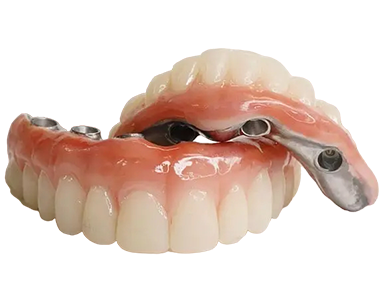 elite ultra fixed bridge